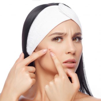 Young woman squeezing her pimple, removing pimple from her face. Woman skin care concept. Acne spot pimple spot skincare beauty care girl pressing on skin problem face.